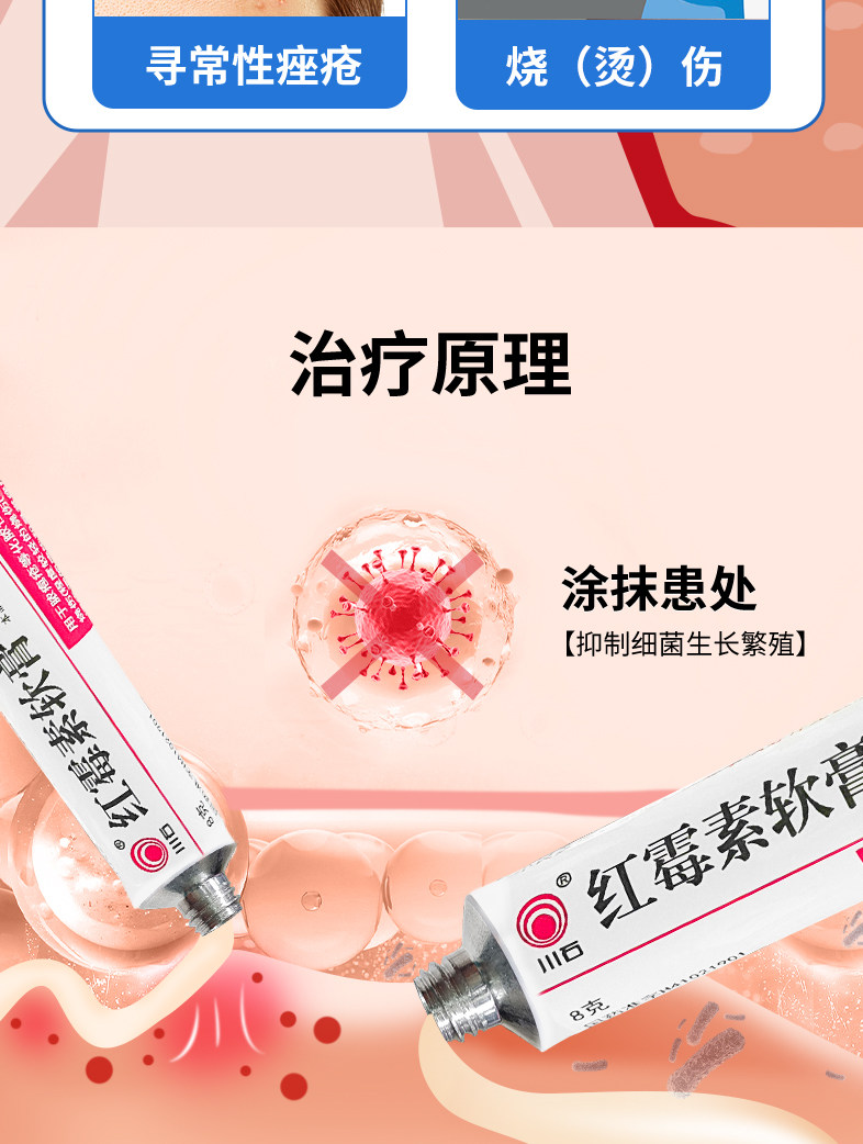 川石   红霉素软膏  抗菌消炎  祛痘 皮炎 烫伤   8g/支