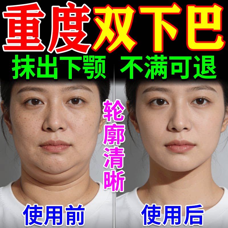 เครื่องมือมหัศจรรย์สำหรับกำจัดไขมันใต้คาง ยกกระชับใบหน้ารูปตัววี กระชับกล้ามเนื้อกราม ลบเส้นกรามล่าง และปรับรูปหน้าให้เรียวเล็ก เหมาะสำหรับทั้งผู้ชายและผู้หญิง