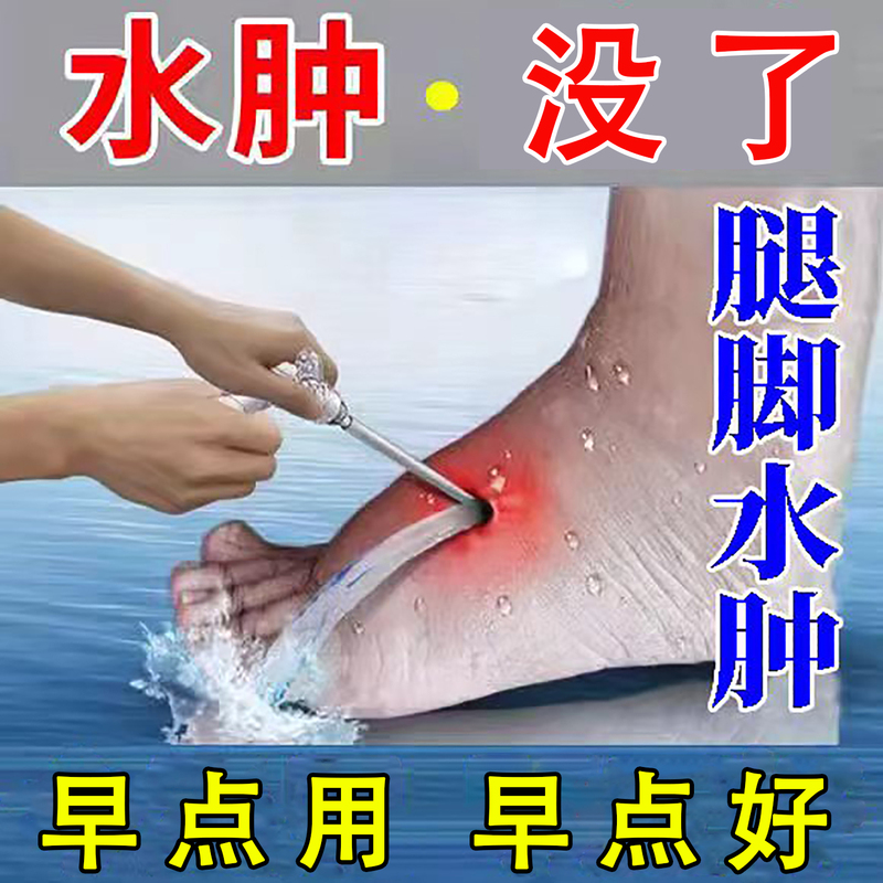 100% Solution for Removing Swelling in Face and Feet, Eliminating Edema, and Reducing Swelling in Legs. Specialized for Elderly People with Leg and Foot Edema 100% Solution for Removing Swelling in Face and Feet, Eliminating Edema, and Reducing Swelling in Legs. Specialized for Elderly People with Leg and Foot Edema