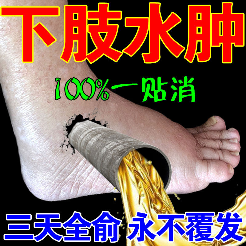 Eliminate edema of the lower extremities artifact to eliminate edema feet swollen limbs calf edema elderly body edema topical diuretic plaster