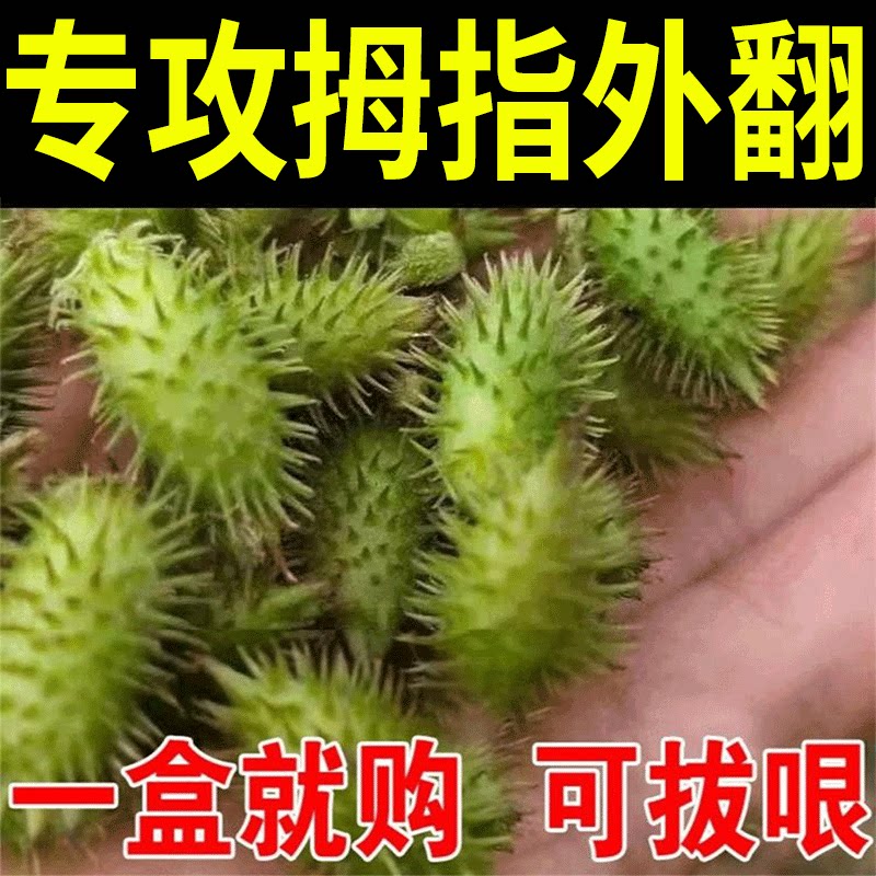 (Straightening of the Visor) Hallux Valgus Delux Thumb Valgus Orthotic Straightener Large Footed Bone Deformation Toe Overlap Anti-Wear JN 