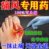 The new version of gout special medicine treats joint dampness and cold pain lowers uric acid dissolves stones removes crystallization cold compress gel analgesic plaster