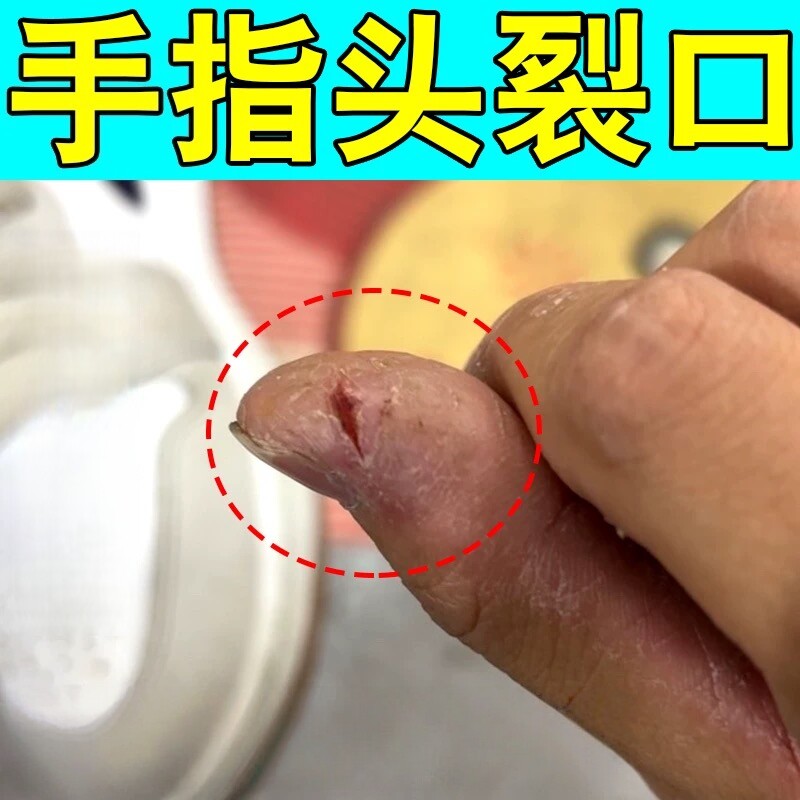 🌟手干燥开裂救星 | 鸢尾猫红花冻裂膏🌿-护手霜-淘宝好物网
