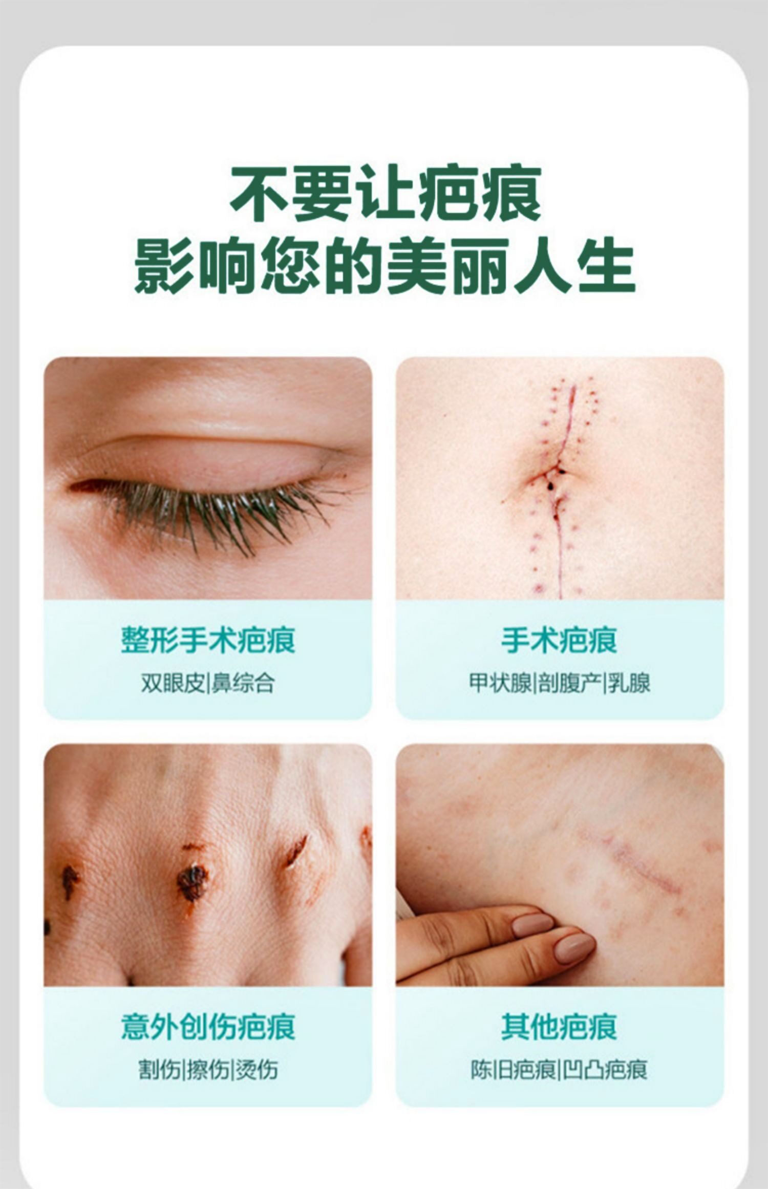 Убрать растяжки массажер 【日本爆款热卖】日系疤痕滚珠修复剖腹产增生凹凸疤痕全身 OTHER