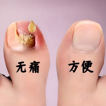 (Watsons best-selling) One drop of it can inhibit bacteria without removing nails and remove 99% of gray potassium fungi. If invalid return guarantee