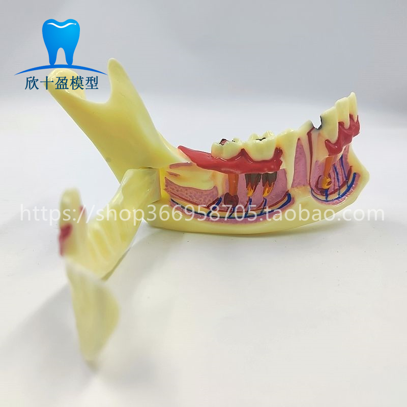 牙科口腔教学模型下颌骨组织分解模型 牙神经牙龈半侧可打开模型
