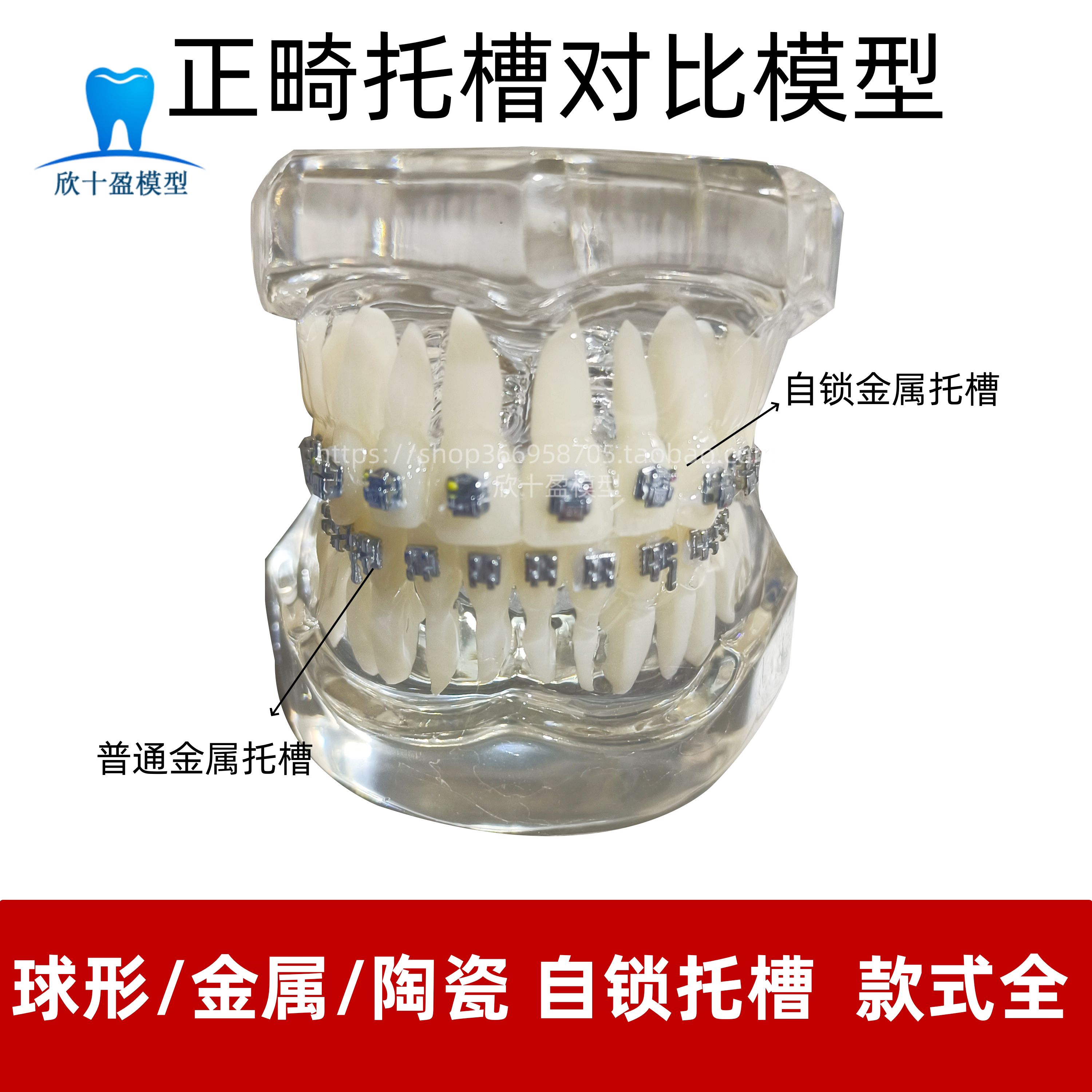 牙科口腔4种托槽对比模型 正畸陶瓷金属自锁托槽托槽示范模型包邮