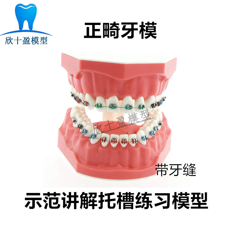 牙科标准正畸模型 带弓丝结扎圈 医患沟通 示范讲解托槽练习模型