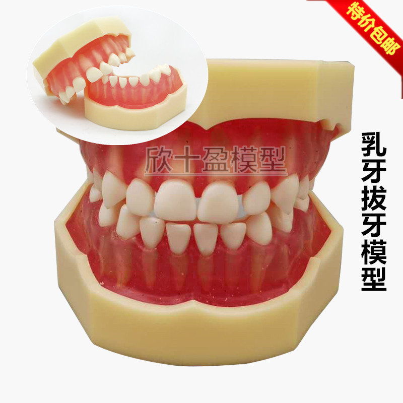 牙科口腔教学模型 标准乳牙可拔牙模型 20颗儿童可拔牙 软牙龈