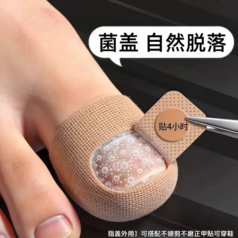 【Hot-Selling Chinese Medicine Product】Plant-Derived Anti-Fungal Nail Stickers, Specialized for Toenails and Fingernails, Genuine Product