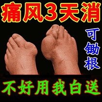 (70-year-old gout) New version of gout special medicine for reducing uric acid heat and crystal clear special joint big toe knee XZ
