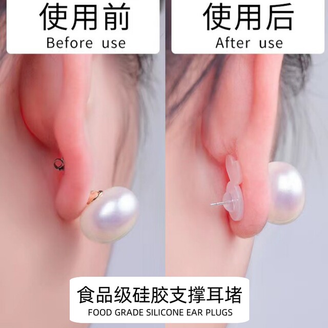 Silicone burger support ear plugs white acrylic transparent ear plugs food grade anti-ear ear plugs ear stud buckle back cap