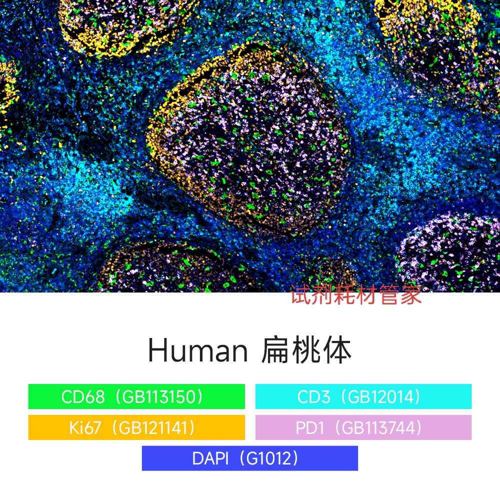 TSA PLus荧光4标5色染色试剂盒 荧光5标6色试剂盒 6标7色试剂盒