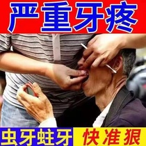 牙痛宁牙痛葯牙疼葯特效消焱喷剂神经上火牙痛蛀牙虫牙洞牙龈肿痛