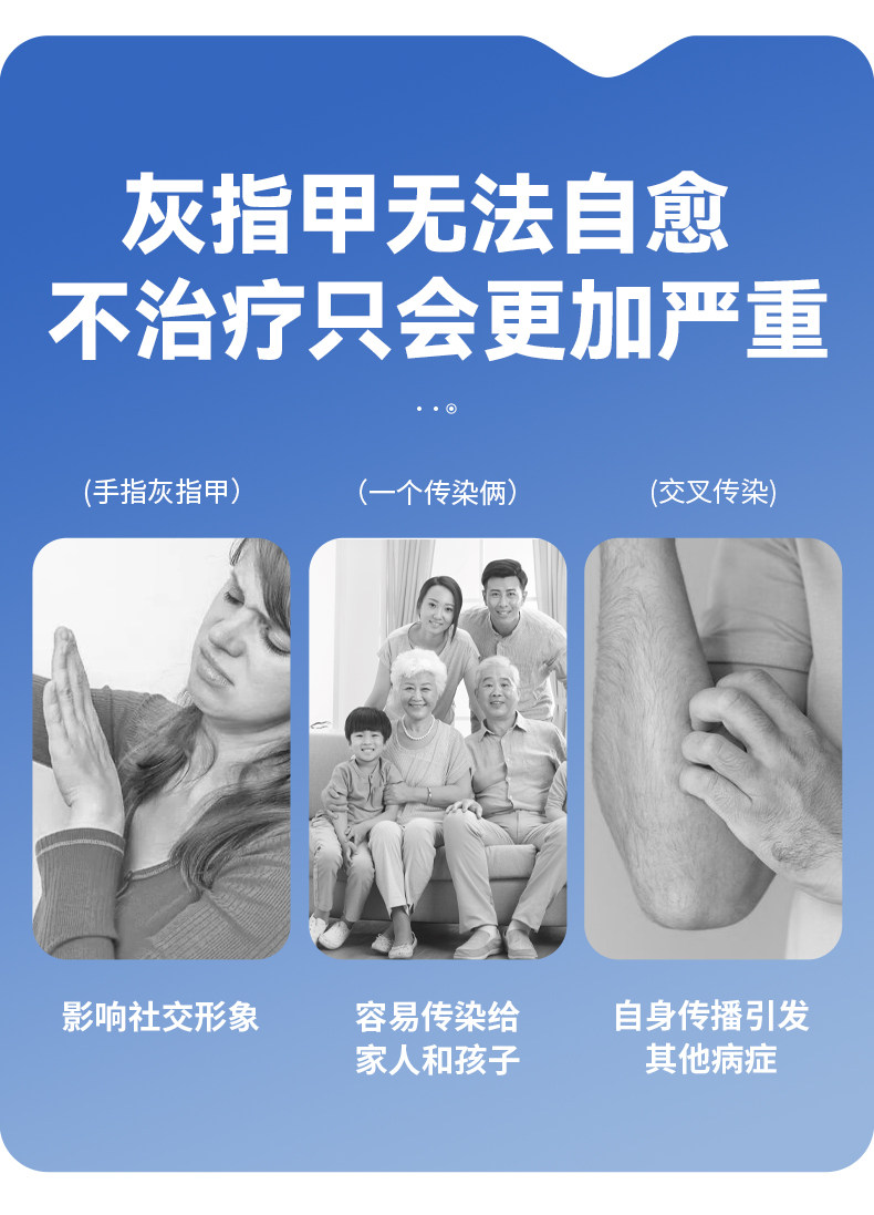 【中國直郵】 洛芙 鹽酸阿莫羅芬搽劑 灰指甲灰指甲專用藥阿羅莫芬搽劑 5%*2ml*1瓶/盒