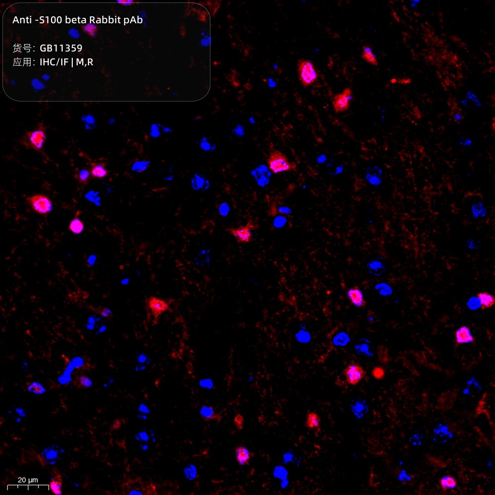 抗-S100&beta;兔pAb抗体,Anti-S100 beta Rabbit pAb,适用IHC/IF 推荐