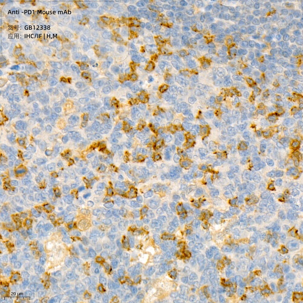 Servicebio抗PD1小鼠单克隆抗体,适用IHC/IF,种属H,细胞杀伤相关