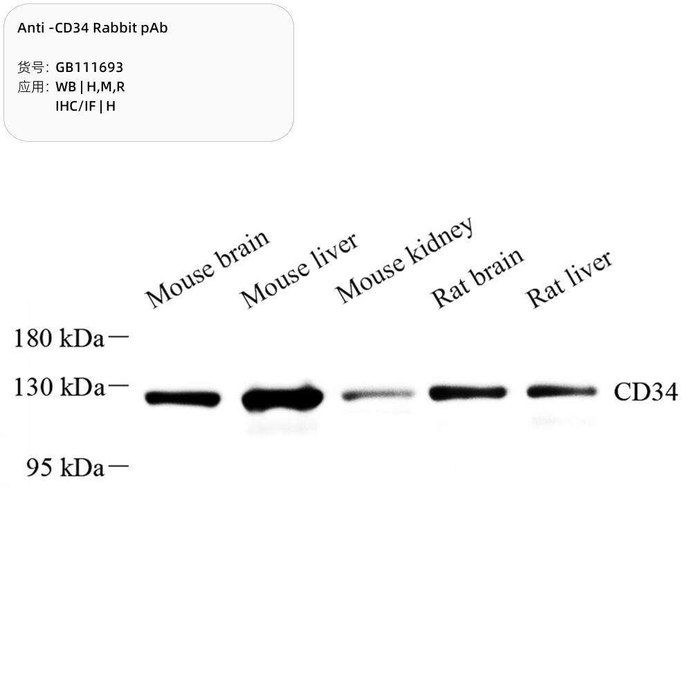 Servicebio抗-CD34兔pAb抗体Anti-CD34 Rabbit pAb,适用WB/IHC/IF