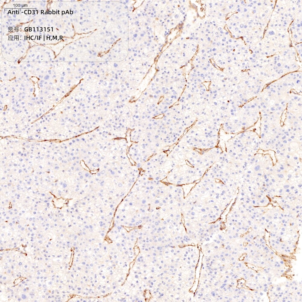 Servicebio抗-CD31兔pAb抗体Anti-CD31 Rabbit pAb适用IHC/IF推荐