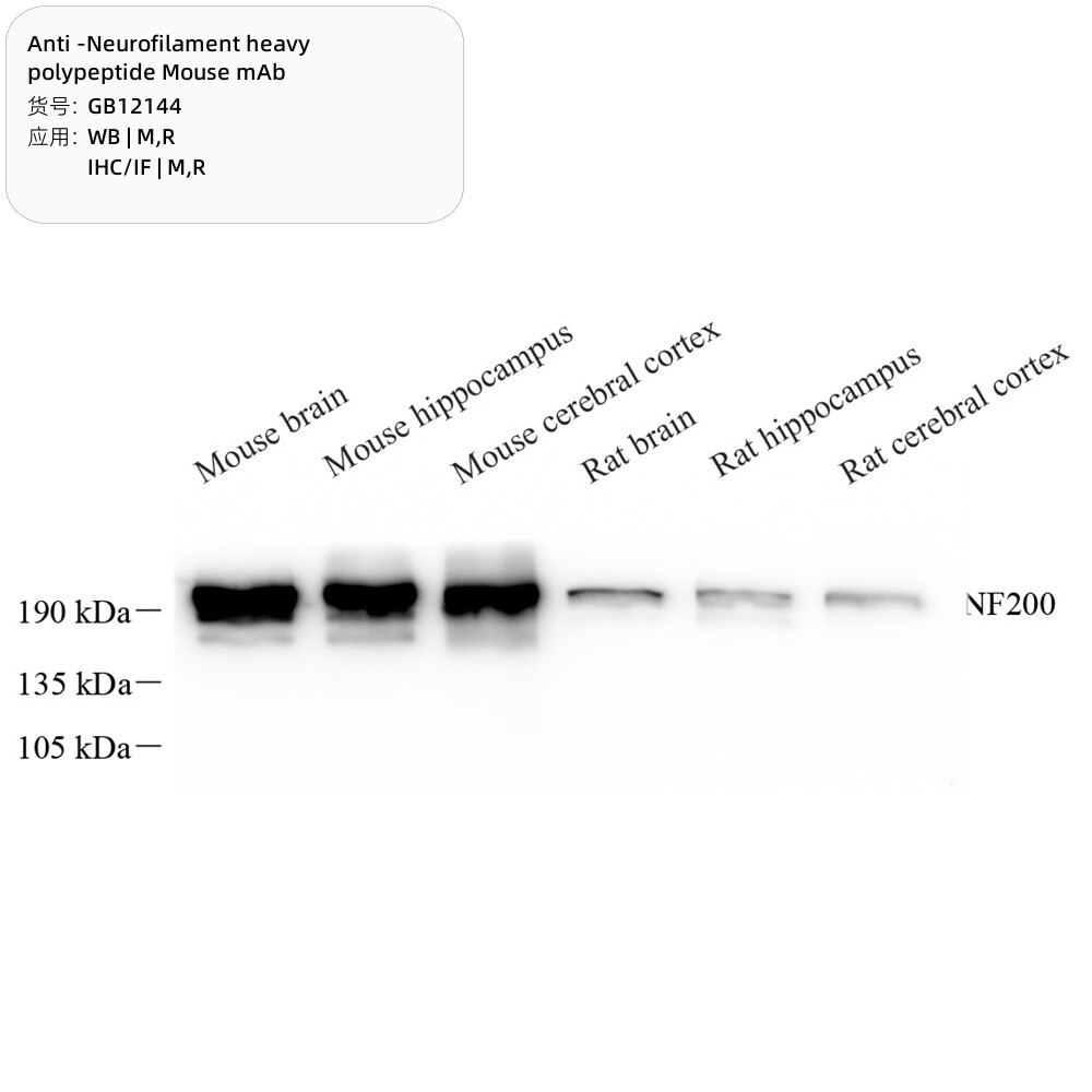 Servicebio抗神经丝重多肽小鼠单克隆抗体,适用WB/IHC/IF,应用M/R