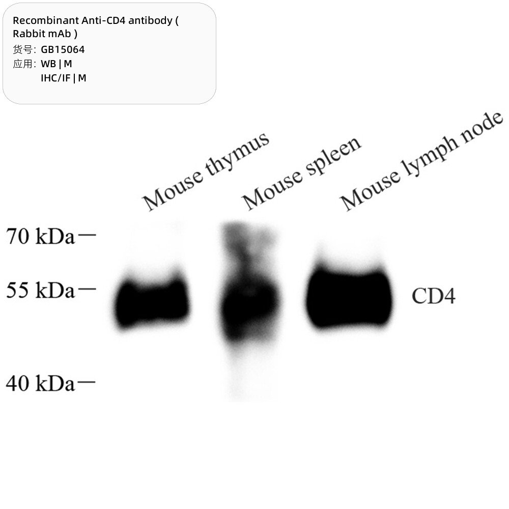 Servicebio 重组抗CD4抗体（兔单抗）,Anti-CD4，GB15064，100&mu;L