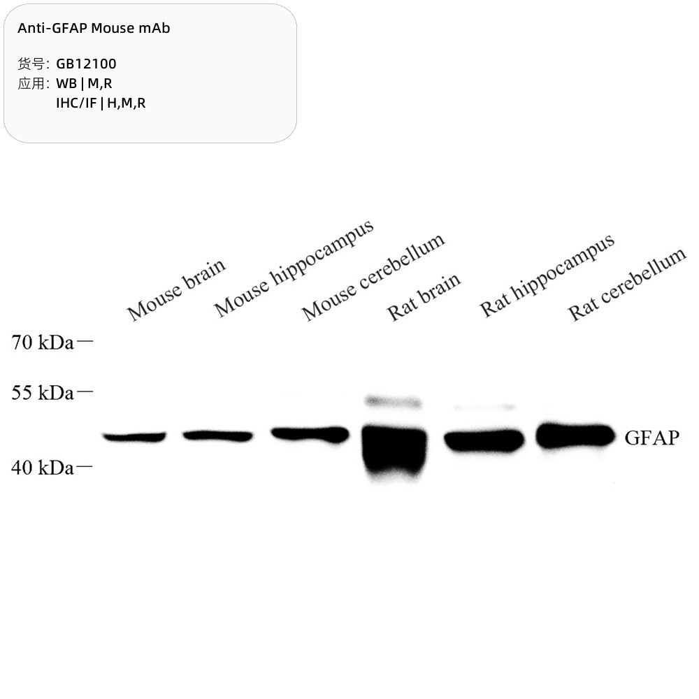 Servicebio抗GFAP小鼠单克隆抗体,适用WB/IHC/IF应用种属H/M/R/Mk