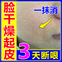 Dry face skin repair moisturizing cream nose face burst skin molting autumn and winter face skin ringworm mens moisturizing milk