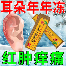 Frostbite ointment detumescence and itching childrens hands feet ears frostbite cracking medicine cracking oil mouth corner cracking quick-acting chilblain medicine