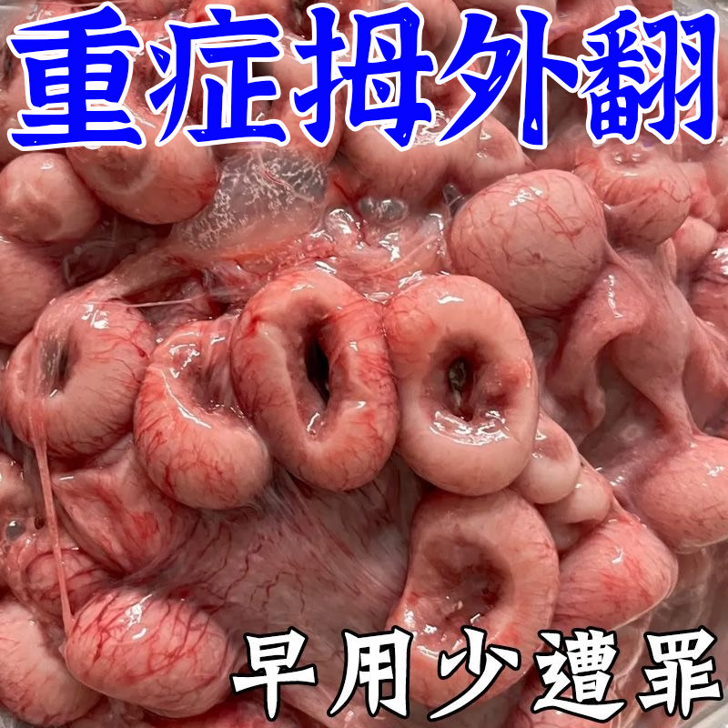 (Large Footed Bone No early use early elimination) Thumb Valgus paste with hallux valgus musculature with large foot bone toe correction sticker-Taobao