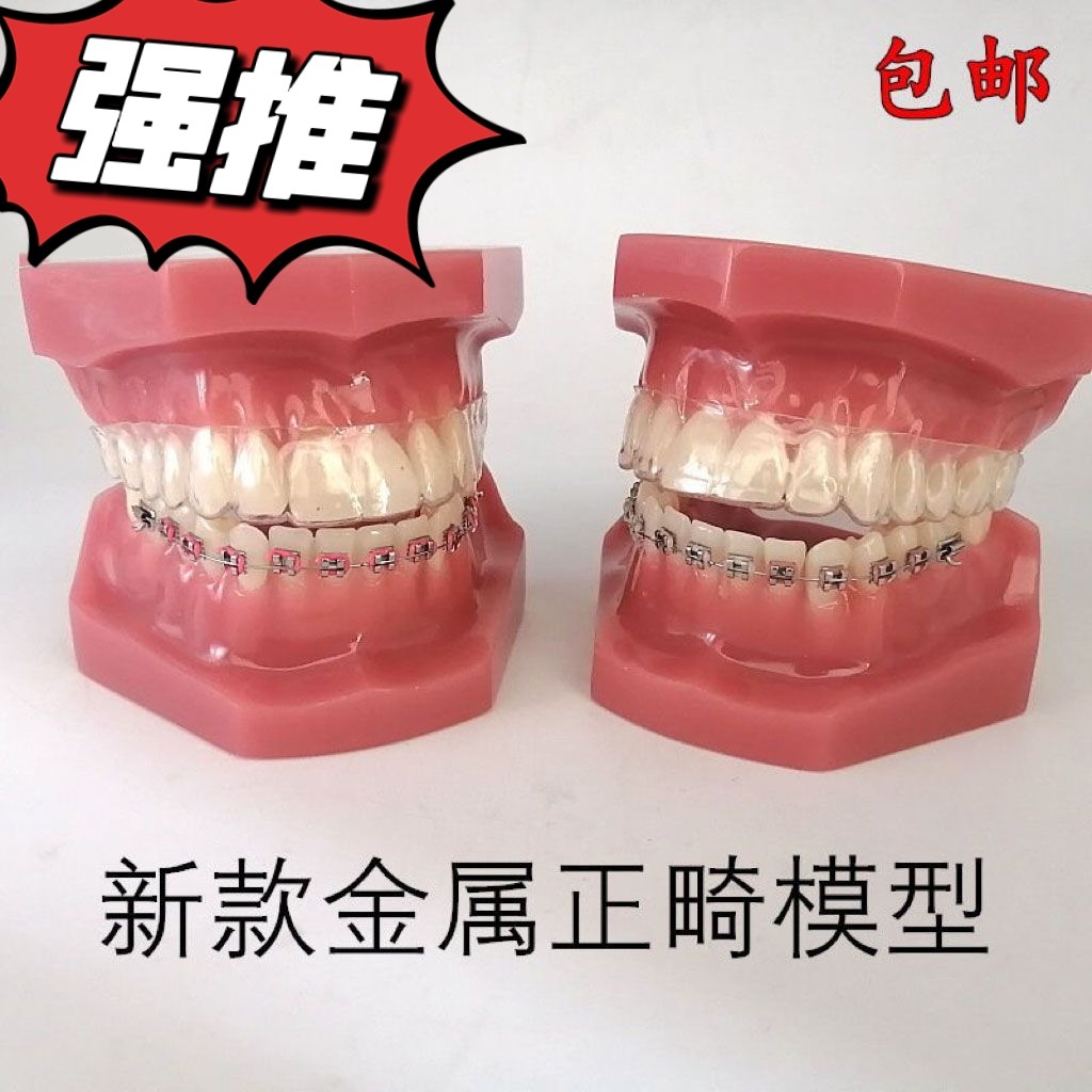 口腔隐形正畸模型 正畸保持器示范 钢丝透明牙套隐形矫正示范牙模