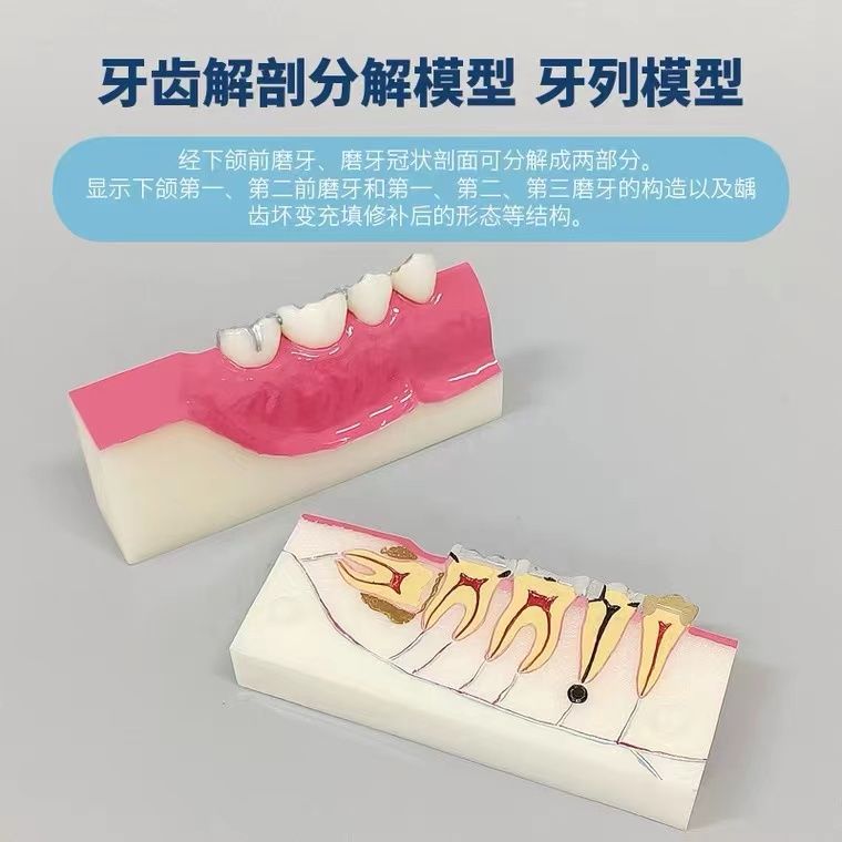 牙齿口腔右下后牙组织分解模型智齿牙齿解刨口腔讲解可拆分模型