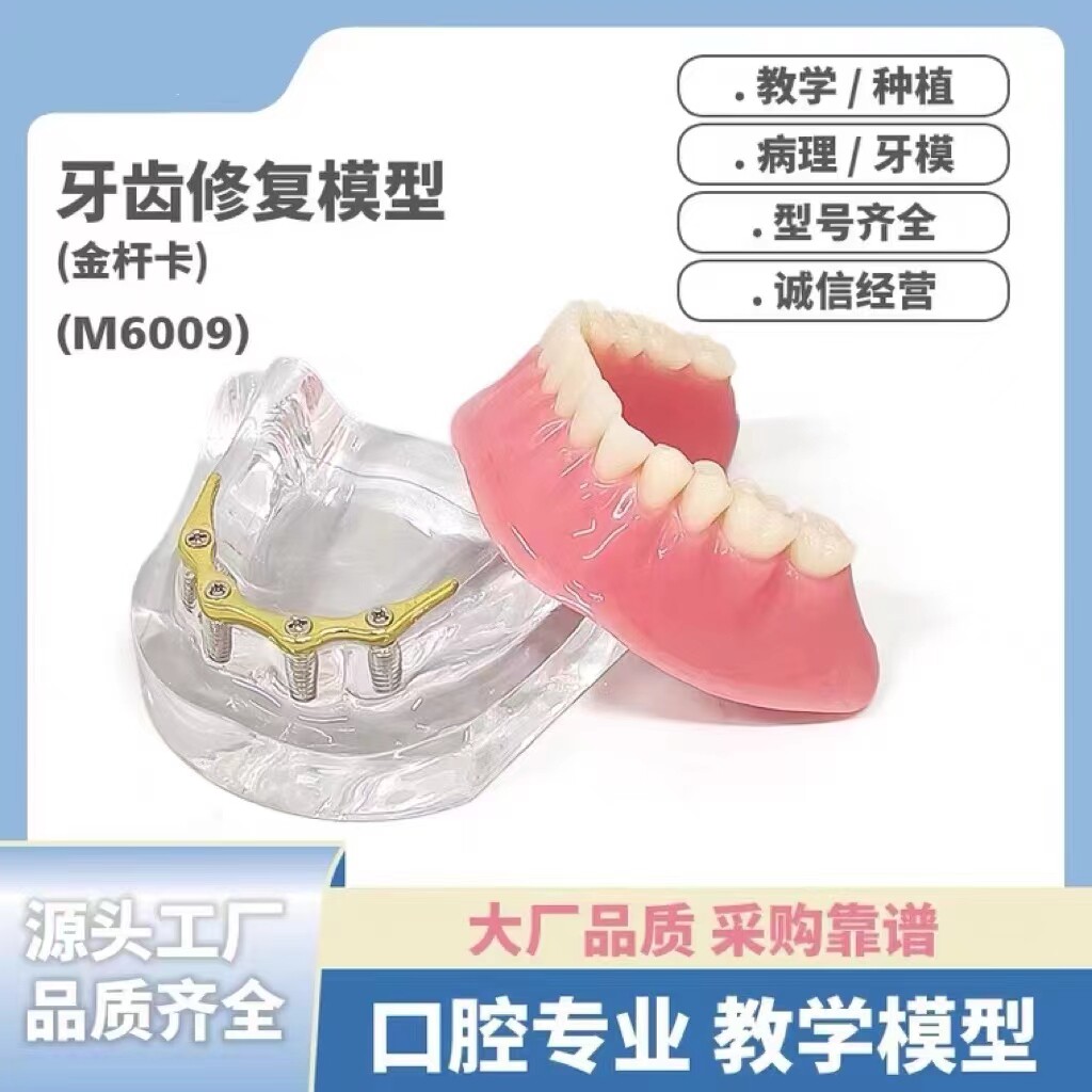 牙齿口腔模型教学种植修复金杆卡牙科仿真半口修复演示水洗可拆卸