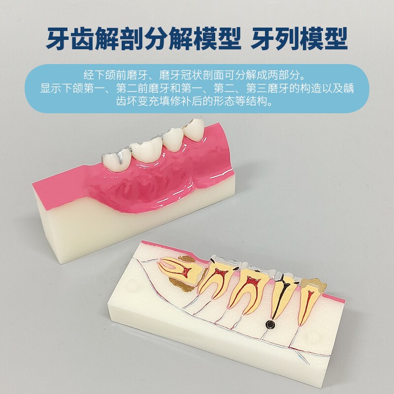 牙齿口腔右下后后牙组织分解模型智齿牙齿解刨口腔讲解可拆分模型