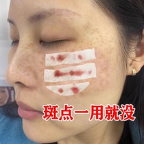 (Recommended by Xiaohongshu) Remove dark spots spots and blemishes on your face. Your face will be clean. Say goodbye to spots~