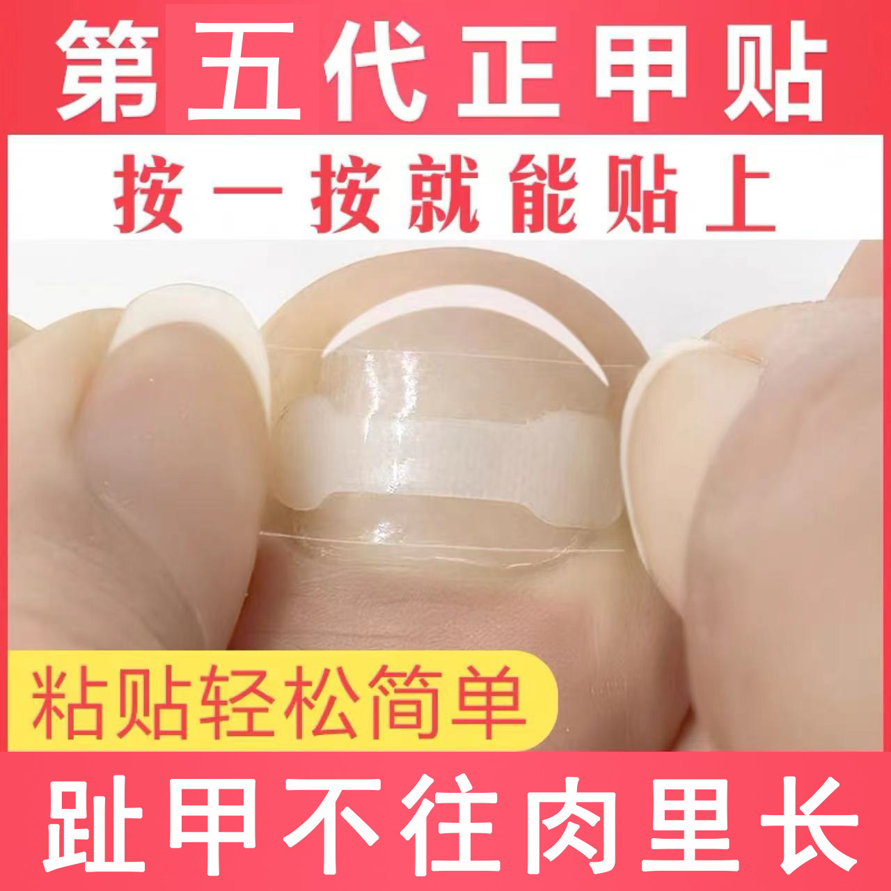 正甲贴甲沟嵌甲矫正器脚指甲往肉里长专用胶水贴拉拉炎神器套修脚