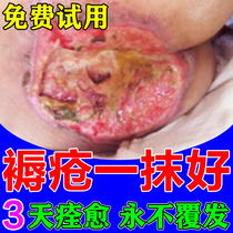 Decubitus wound healing promotes flesh growth removes saprophytic muscle ointment and is a quick and effective ointment for wounds and external use on the buttocks of the elderly.