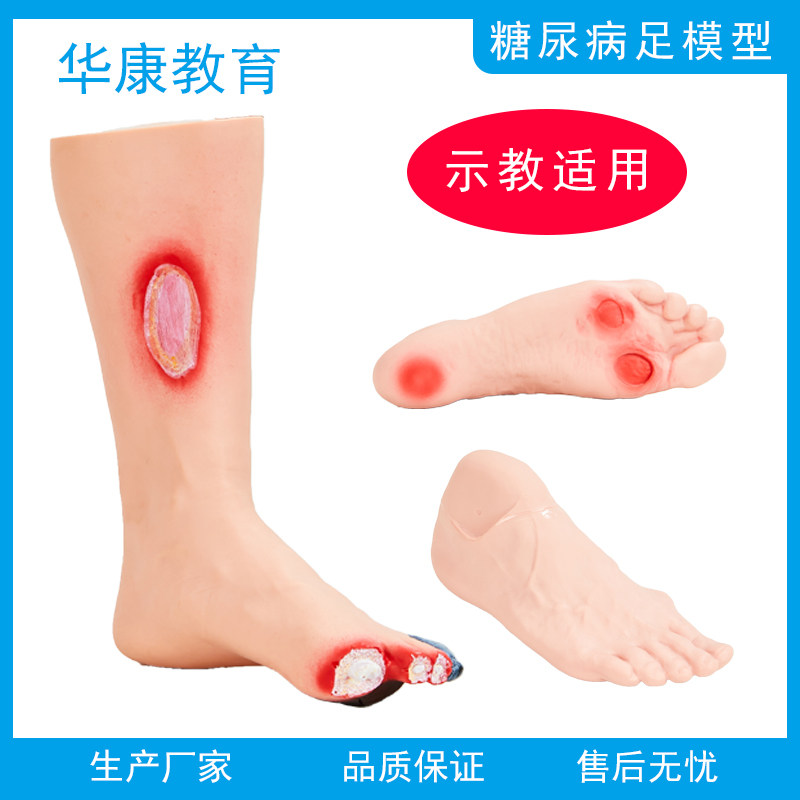 糖尿病足护理模型烂脚烂腿老年护理模具医学足背动脉示教模型