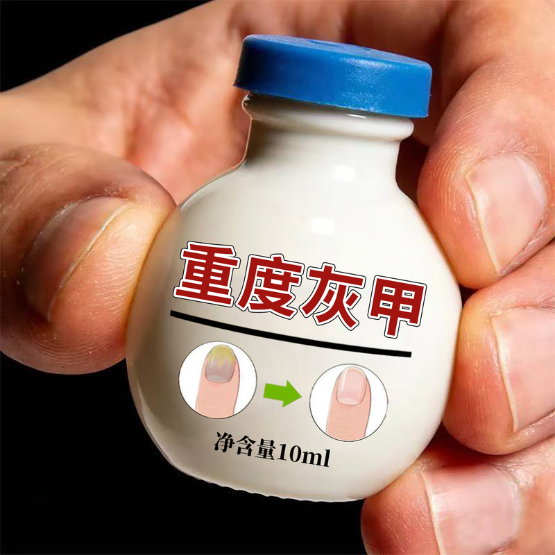 Hong Kong Nail Brightening Gray Thickening Nail Liquid Ointment for Severe Thick Nails on Toes and Fingers, Genuine Special Nail Cleaner