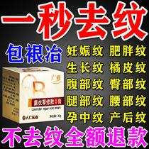 Stretch Marks Elimination Stretch Marks Firming Belly Repair Cream Postpartum Elimination Obesity Marks Scar Removal Cream