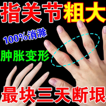 Tablette rouge de Shenyang arthrite rhumatismale médecine spéciale pour éliminer le vent et déshumidifier et soulager la douleur et soulager la douleur