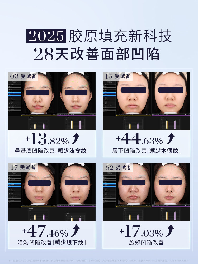 [New Year Carnival Instant Discount of 550] Gemo Jinmo 4R Collagen Machine Home Anti-Aging Collagen Cannon Facial Beauty Device