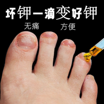 Its too good to not fix it sooner or later its too good a bad nail to change a good A finger toe to repair a good potassium