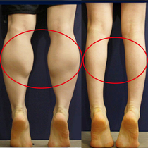 (Hot Pin Recommendation) Buy 5 send 5 Inverse Assaulter Small Waist Fine Leg Finer LAZY person to receive male and female universal