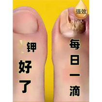 Tongrentang hot sale drop by drop bad nails will turn into good nails new nails will grow enjoy a life of good nails take the photo and get an instant discount