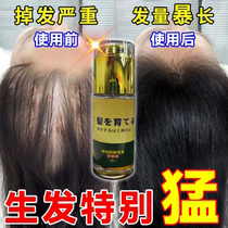 Hair loss severely for men and women with hair spill in hair spill