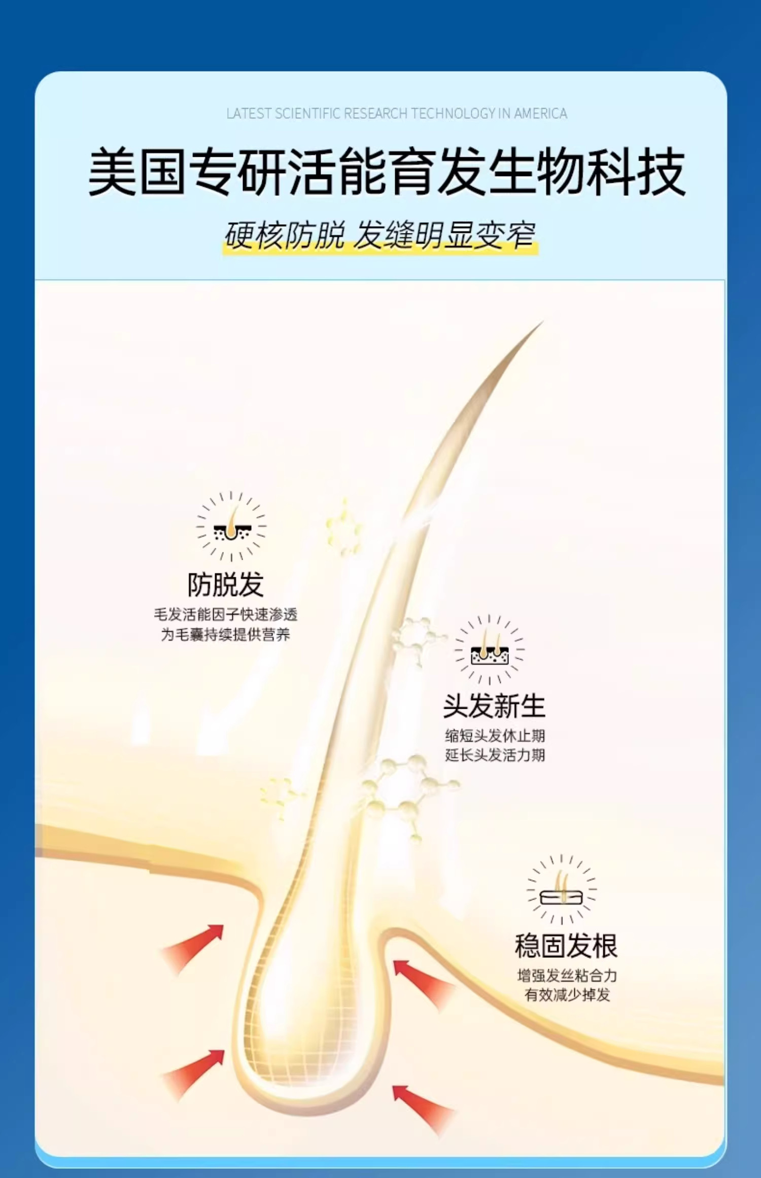 【香港直邮】 OHBT 防脱育发精华 100ml 男女通用 油头救星 打造健康头皮