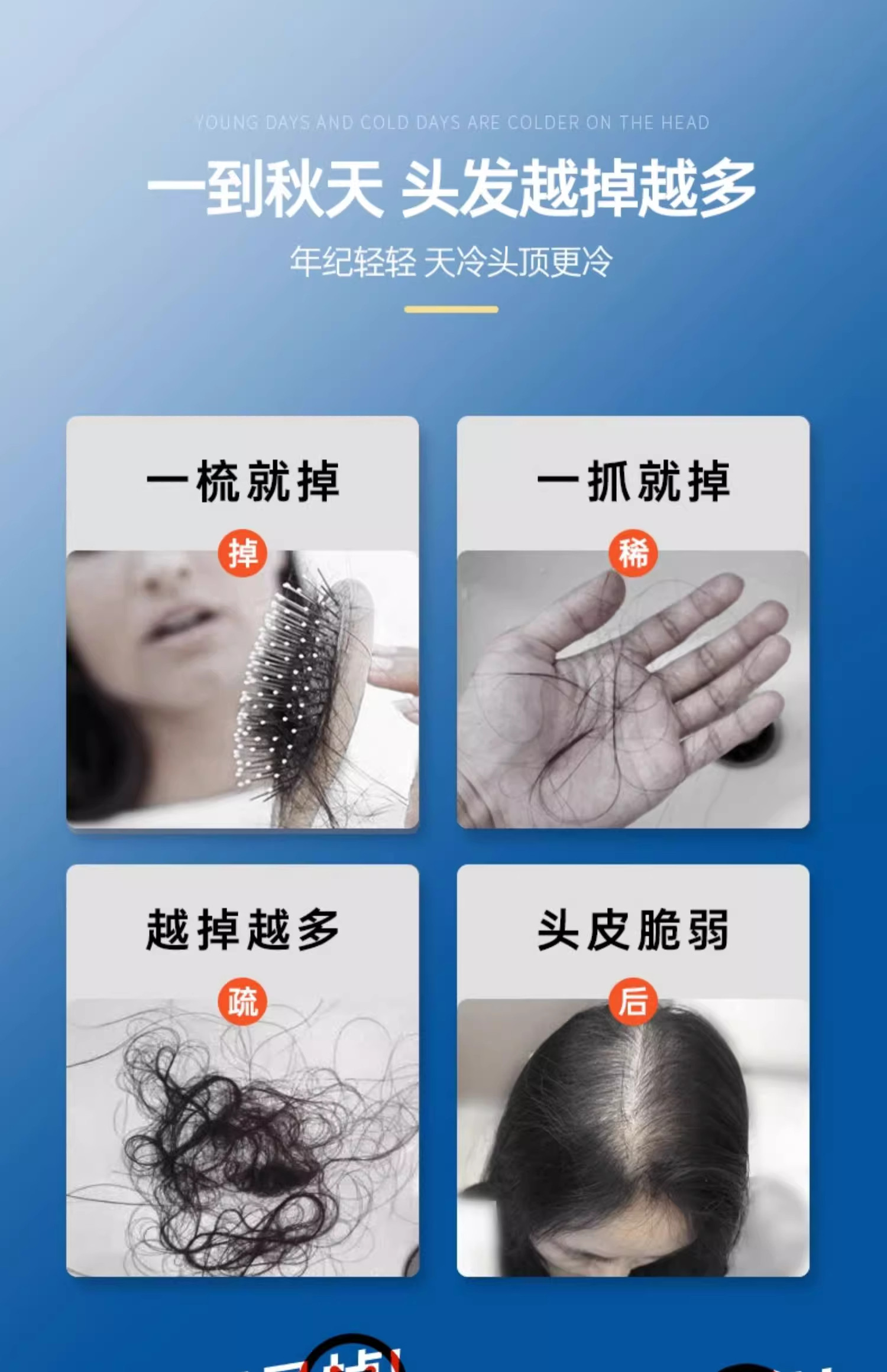 【香港直邮】 OHBT 防脱育发精华 100ml 男女通用 油头救星 打造健康头皮