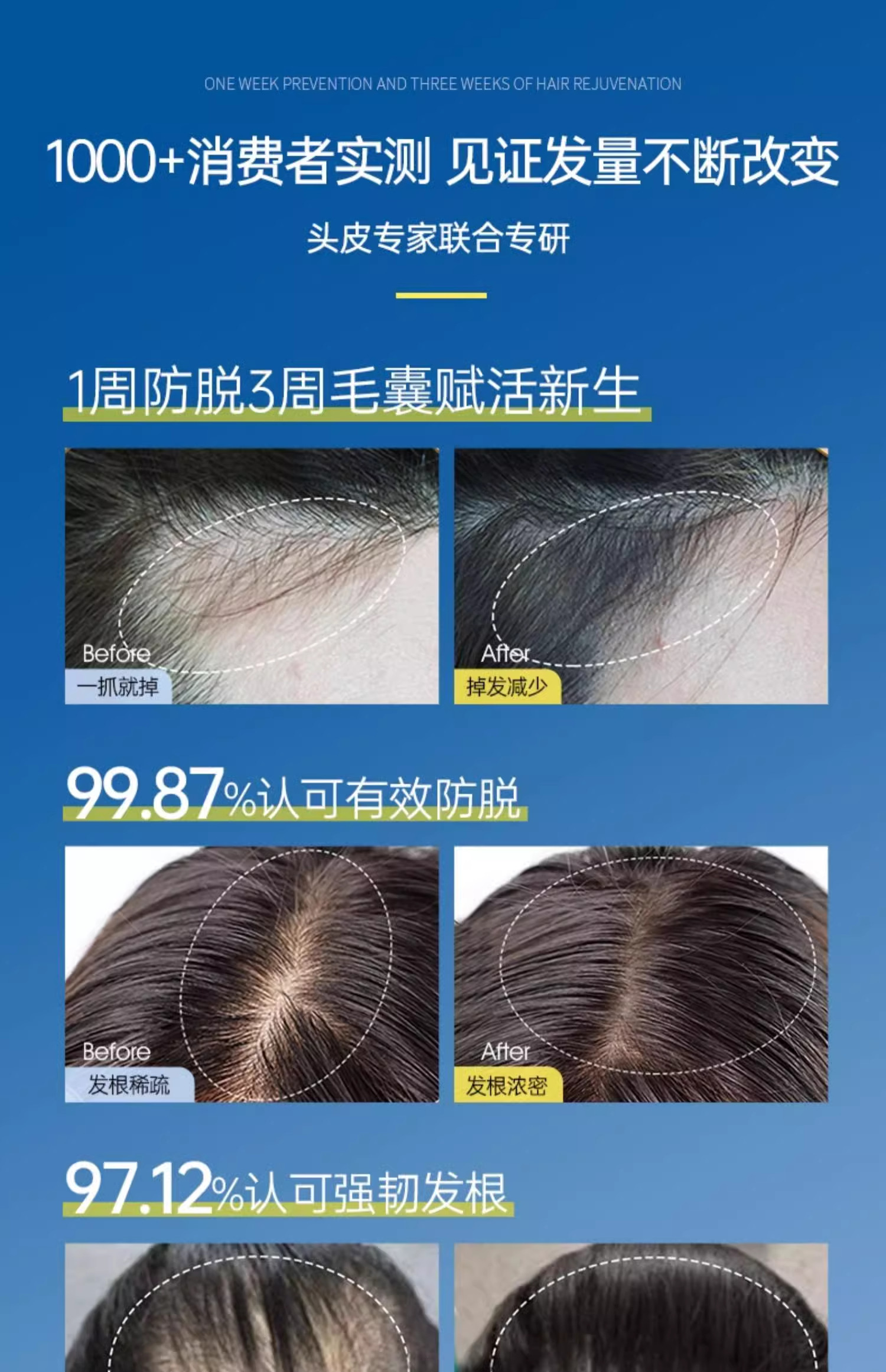 【香港直邮】 OHBT 防脱育发精华 100ml 男女通用 油头救星 打造健康头皮