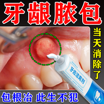 Gingival abscess Gingival Inflammation of Gingival Inflammation of Gingival Gingivitis Special Toothpaste for Gingigingivitis