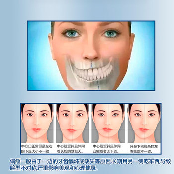Orthognathic correction for large and small faces to correct the retraction of the chin and face distortion